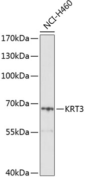 KRT3 Polyclonal Antibody