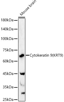 Cytokeratin 9 (KRT9) Polyclonal Antibody