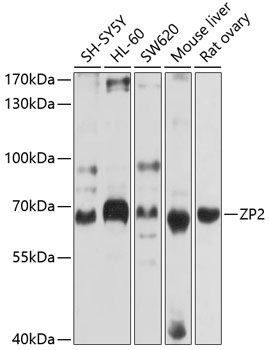 ZP2 Polyclonal Antibody