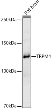 TRPM4 Polyclonal Antibody