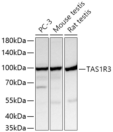 TAS1R3 Polyclonal Antibody