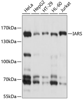 IARS Polyclonal Antibody