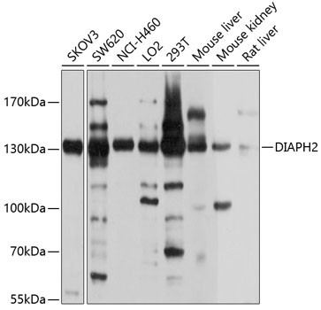 DIAPH2 Polyclonal Antibody