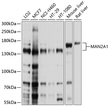 MAN2A1 Polyclonal Antibody