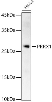 PRRX1 Polyclonal Antibody