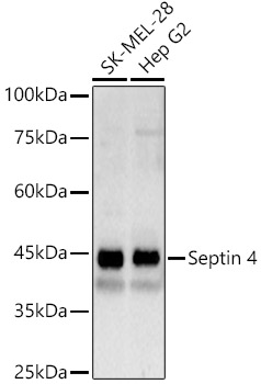 Septin 4 Polyclonal Antibody
