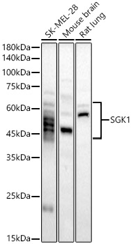 SGK1 Polyclonal Antibody