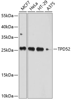 TPD52 Polyclonal Antibody