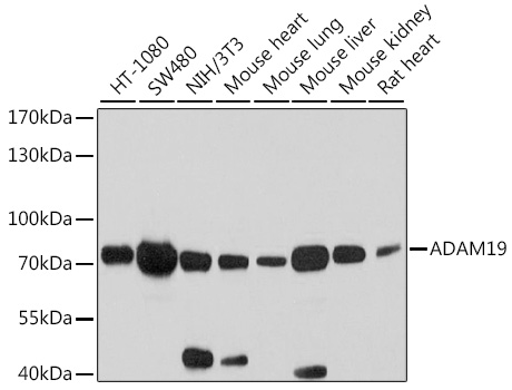 ADAM19 Polyclonal Antibody&nbsp;<img src="images/icon_newarrival.gif" alt="new" border="0">
