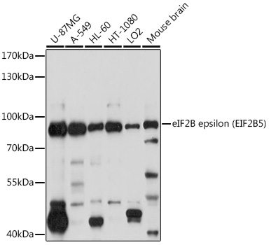 eIF2B epsilon (EIF2B5) Polyclonal Antibody