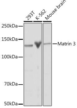 Matrin 3 Monoclonal Antibody [10O1D1]