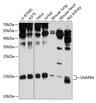 SNAPIN Polyclonal Antibody