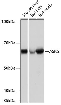 ASNS Monoclonal Antibody [7M10Z7]