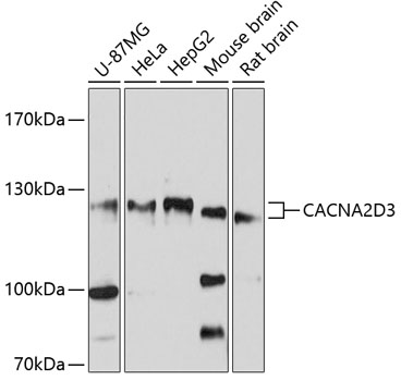 CACNA2D3 Polyclonal Antibody