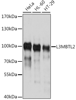 L3MBTL2 Polyclonal Antibody
