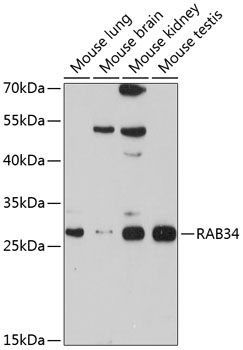 RAB34 Polyclonal Antibody