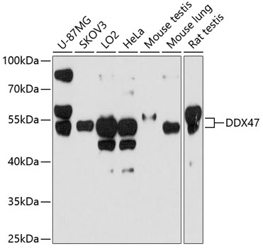 DDX47 Polyclonal Antibody