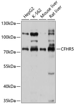 CFHR5 Polyclonal Antibody