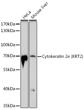 Cytokeratin 2e (KRT2) Polyclonal Antibody