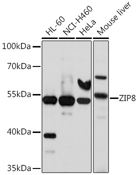 ZIP8 Polyclonal Antibody
