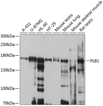 PLB1 Polyclonal Antibody