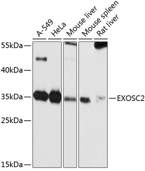 EXOSC2 Polyclonal Antibody