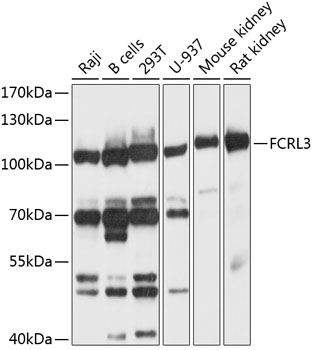 FCRL3 Polyclonal Antibody