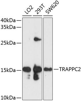 TRAPPC2 Polyclonal Antibody
