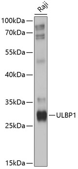 ULBP1 Polyclonal Antibody