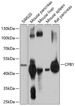 CPB1 Polyclonal Antibody