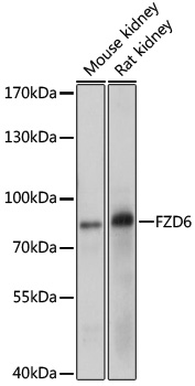 FZD6 Polyclonal Antibody