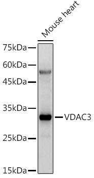 VDAC3 Polyclonal Antibody