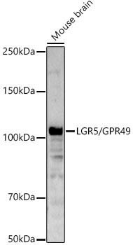 LGR5/GPR49 Polyclonal Antibody