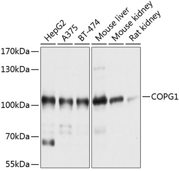 COPG1 Polyclonal Antibody