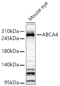 ABCA4 Polyclonal Antibody&nbsp;<img src="images/icon_newarrival.gif" alt="new" border="0">