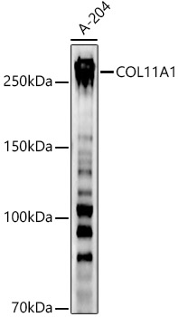 COL11A1 Polyclonal Antibody