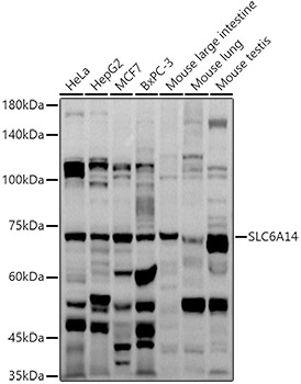 SLC6A14 Polyclonal Antibody