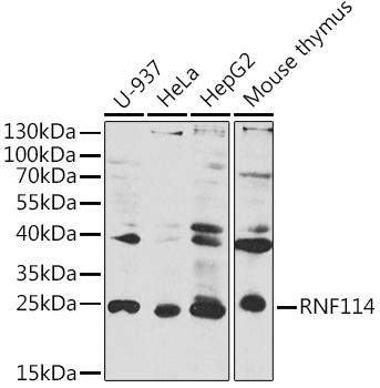 RNF114 Polyclonal Antibody