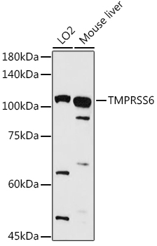 TMPRSS6 Polyclonal Antibody