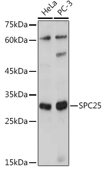 SPC25 Polyclonal Antibody