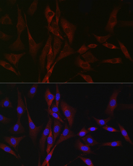 CACNA1H Polyclonal Antibody