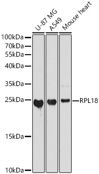 RPL18 Polyclonal Antibody