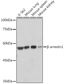 B-arrestin1 Monoclonal Antibody [F7C2]