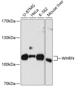WHRN Polyclonal Antibody