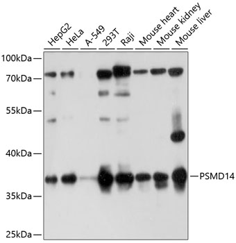 PSMD14 Polyclonal Antibody