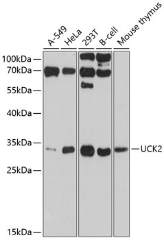 UCK2 Polyclonal Antibody