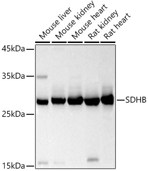SDHB Polyclonal Antibody