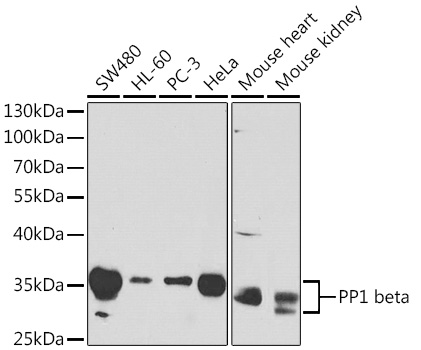 PP1 beta Polyclonal Antibody