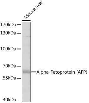 Alpha-Fetoprotein (AFP) Polyclonal Antibody