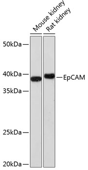 EpCAM Monoclonal Antibody [2Y2E0]